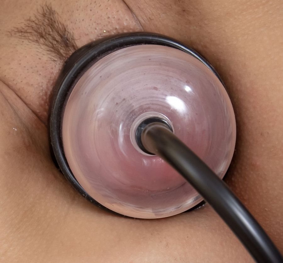 Close up of a vacuum dome placed over female genitals for vacuum suction.